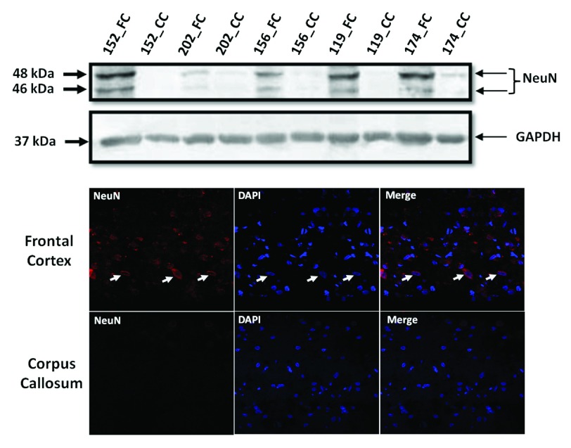 Frontal cortex is enriched for neuronal cells.